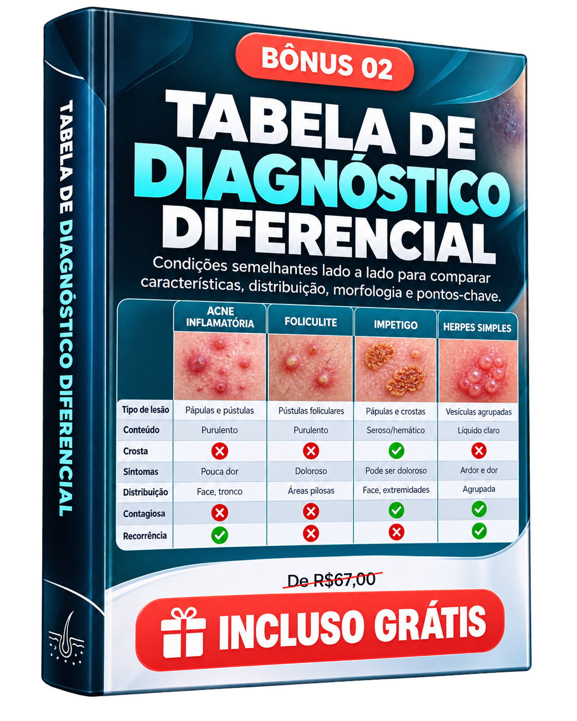 Bônus 02 — Tabela de Diagnóstico Diferencial