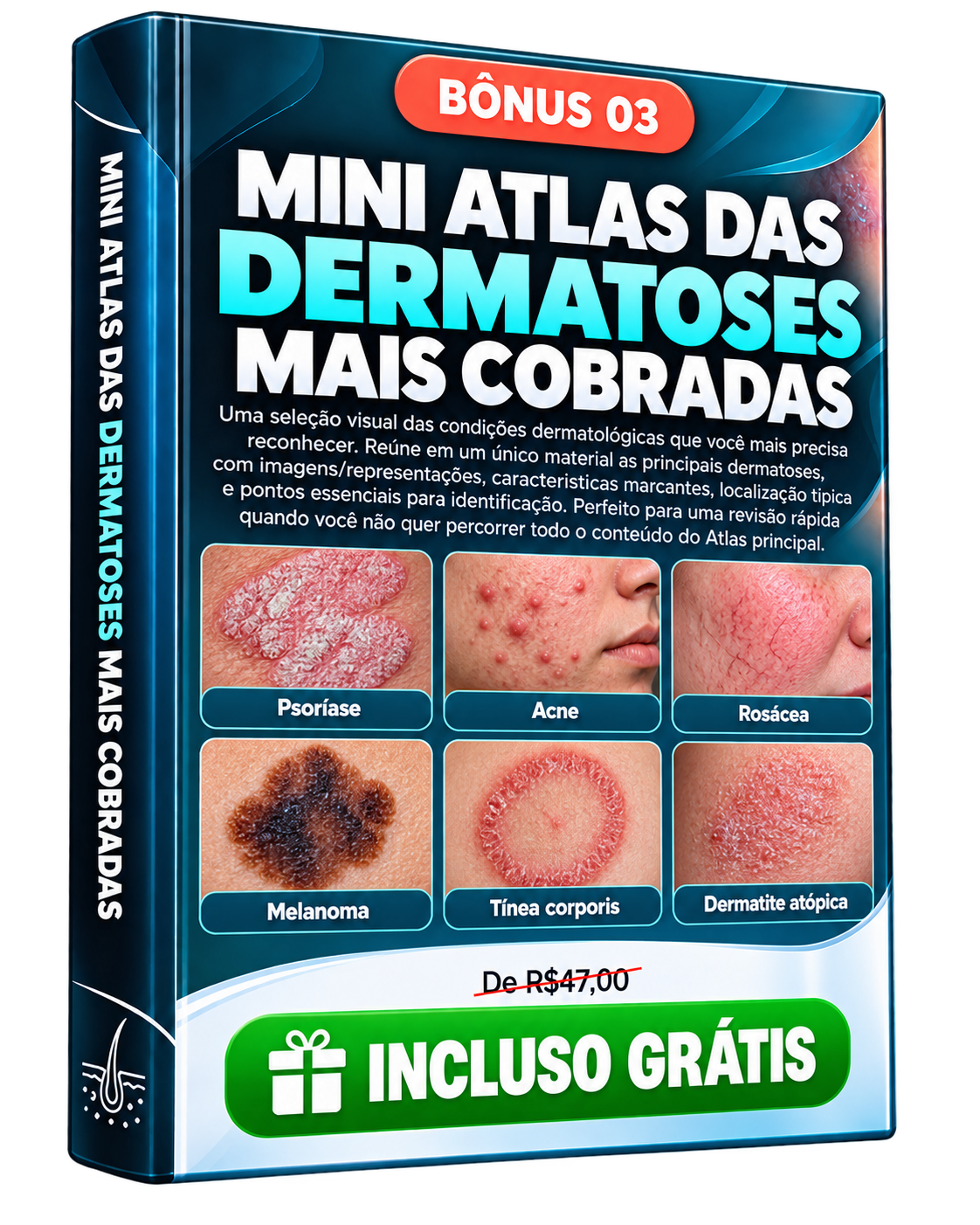 Bônus 03 — Mini Atlas das Dermatoses Mais Cobradas
