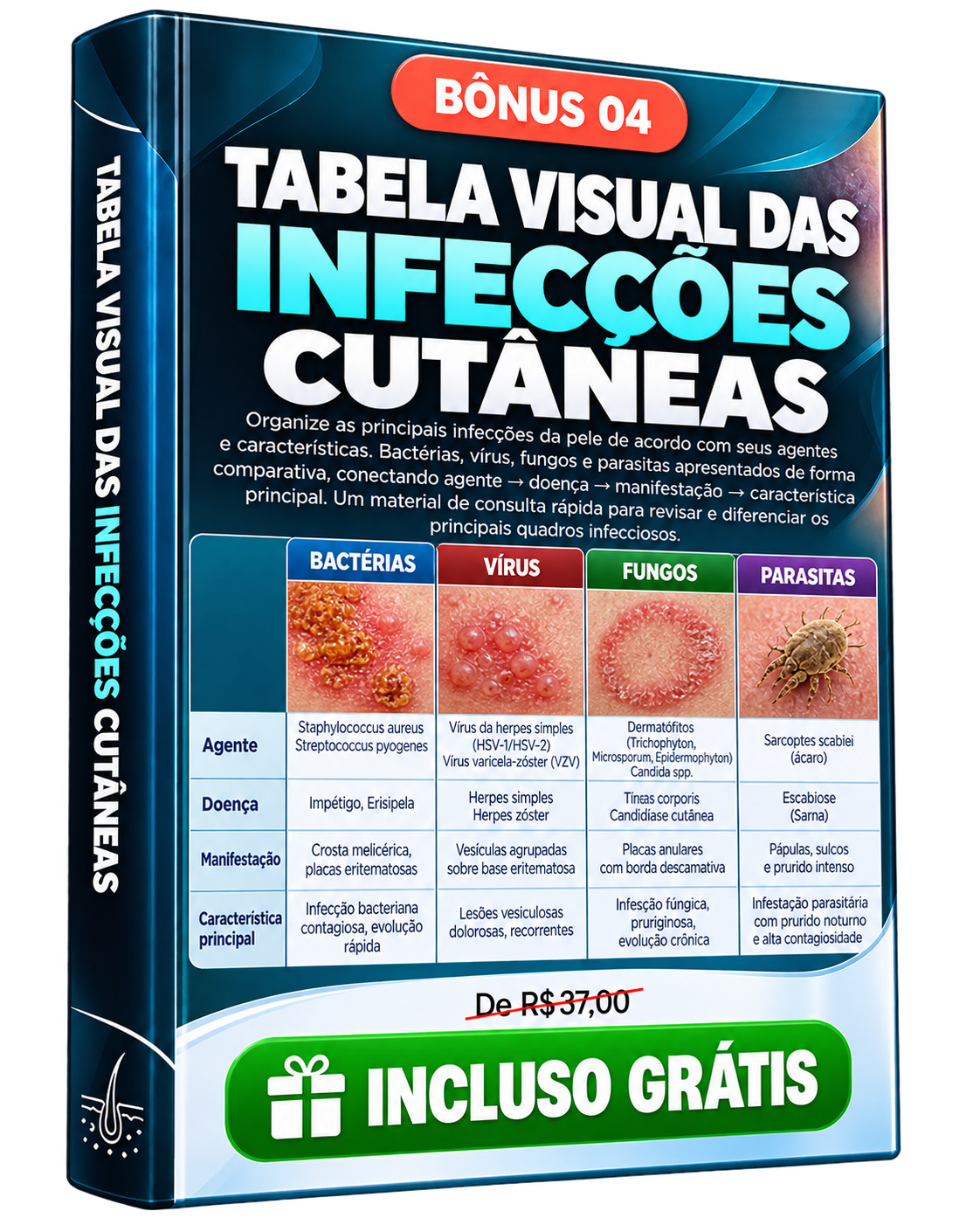 Bônus 04 — Tabela Visual das Infecções Cutâneas